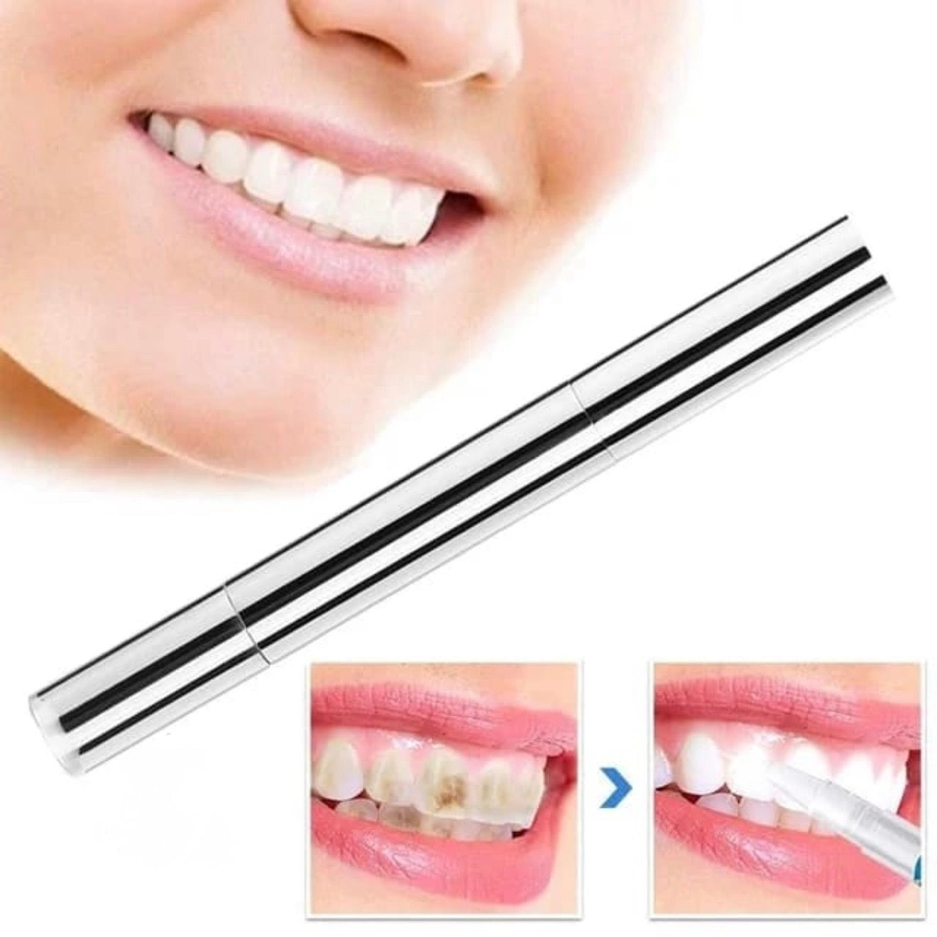 Teeth Whitening Gel Pen #TF036