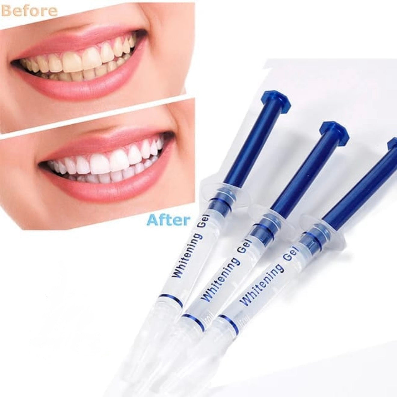 Professional Teeth Whitening Gel #TF016